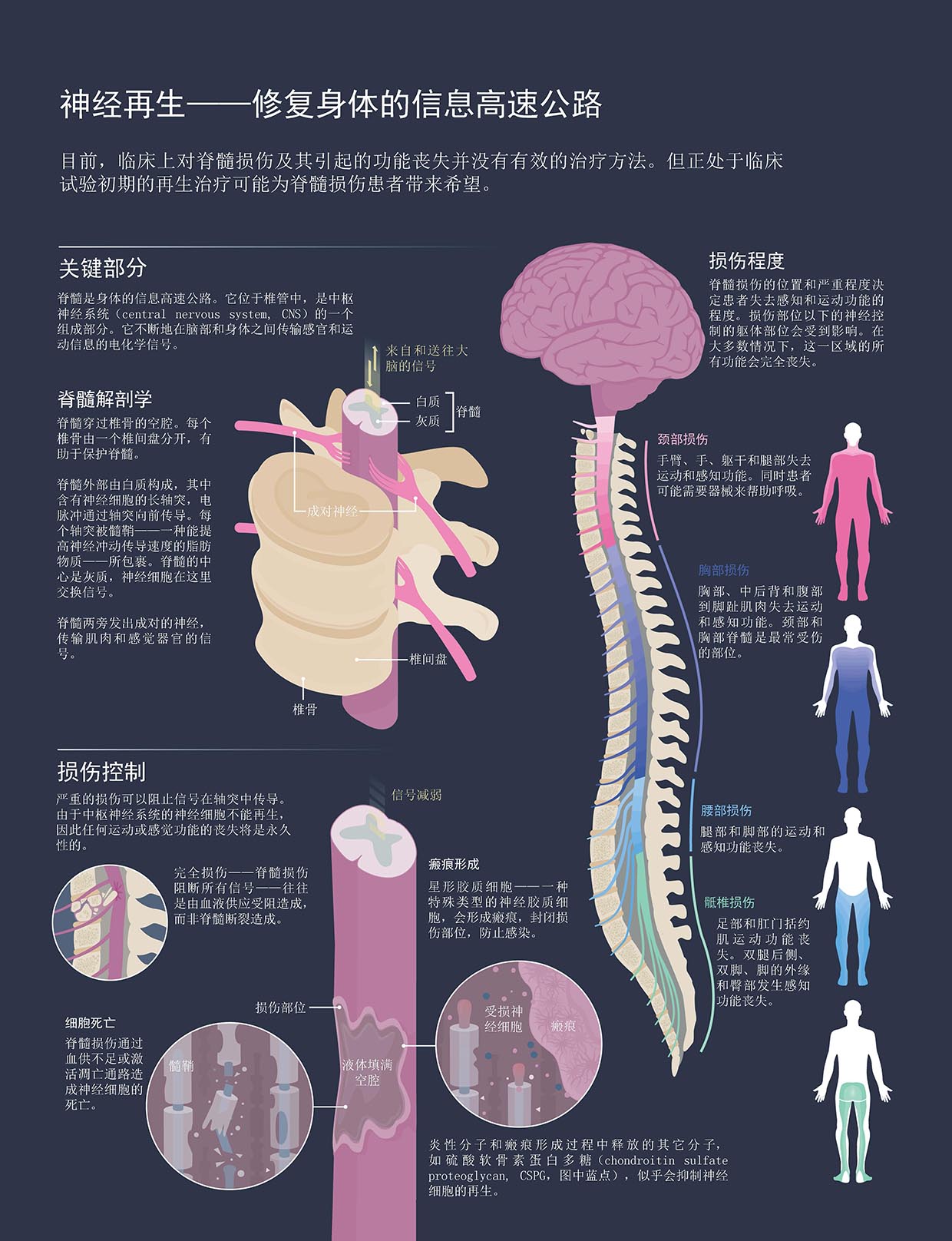 香港脊髓研究最新突破，开启脊髓疾病治疗新篇章